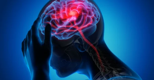 Read more about the article Apa itu Disonansi Kognitif?, dan Bagaimana Ini Mempengaruhi Perilaku Kita?