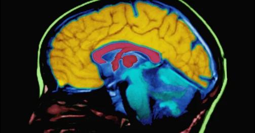 Read more about the article Mengatasi Konflik Internal: Solusi Praktis Mengatasi Disonansi Kognitif